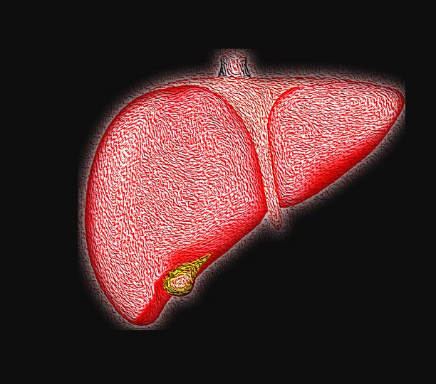 Fecal transplants non-alcoholic fatty liver disease