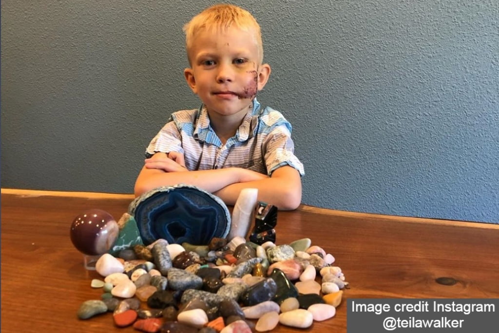 Bridger Walker saved sister from dog attack