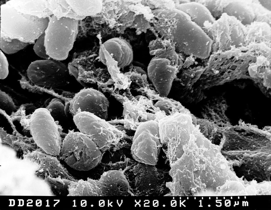 What is Bubonic plague
