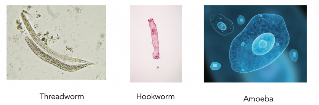 Types of Intestinal Worms, Worms in Human poop Pictures